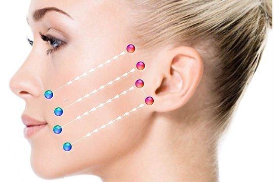 Gesichtsstraffung Facelift Türkei / Antalya – Kosten: ab 3.990 EUR