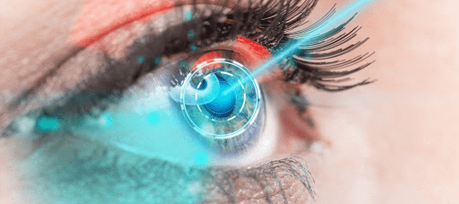 Augenlaser in der Türkei