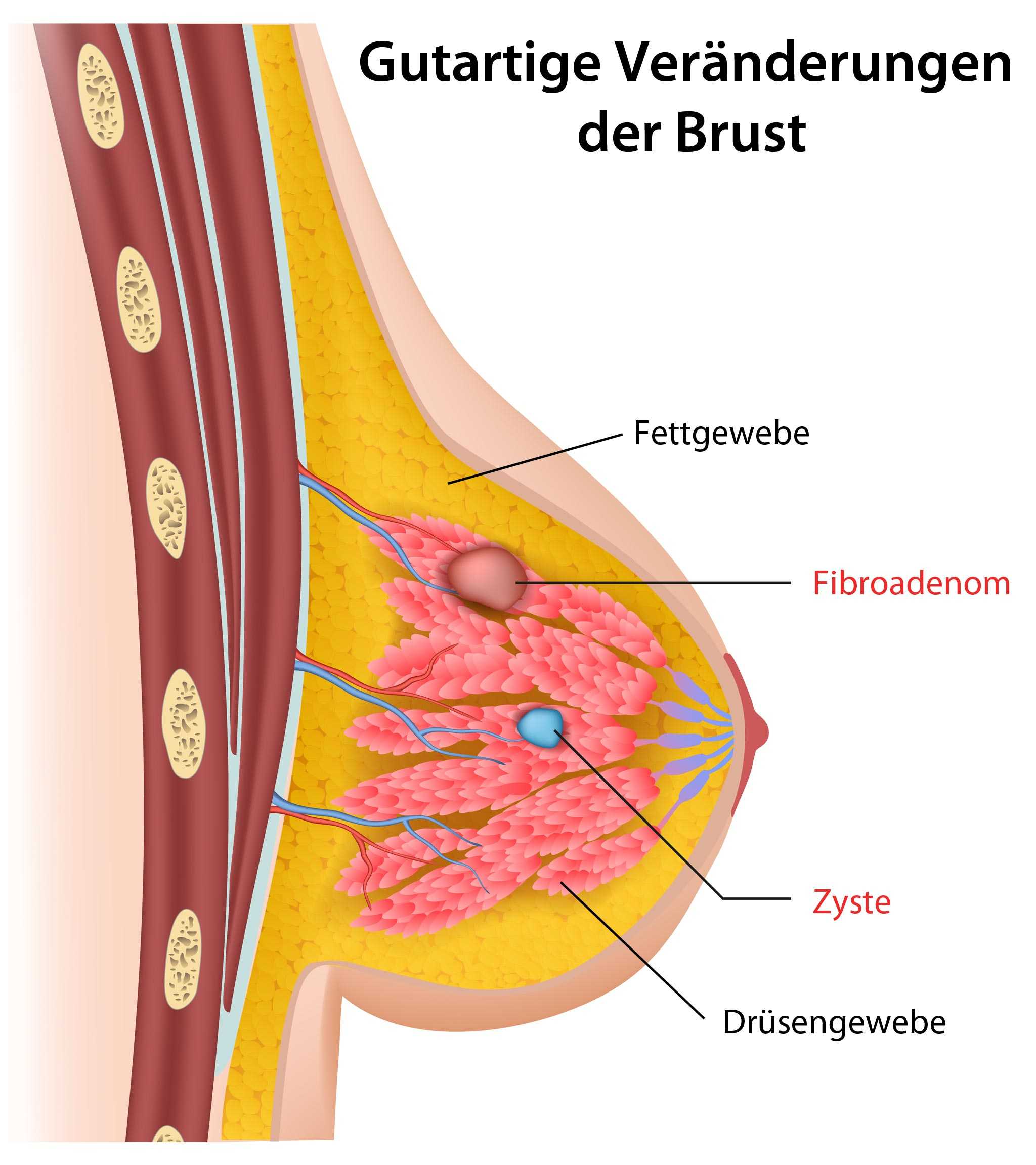 Brustoperation Türkei