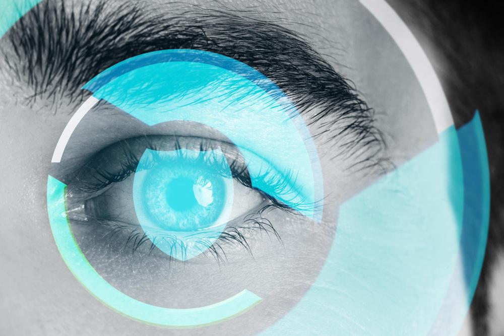 LASIK oder LASEK türkei antalya kosten augenlasern