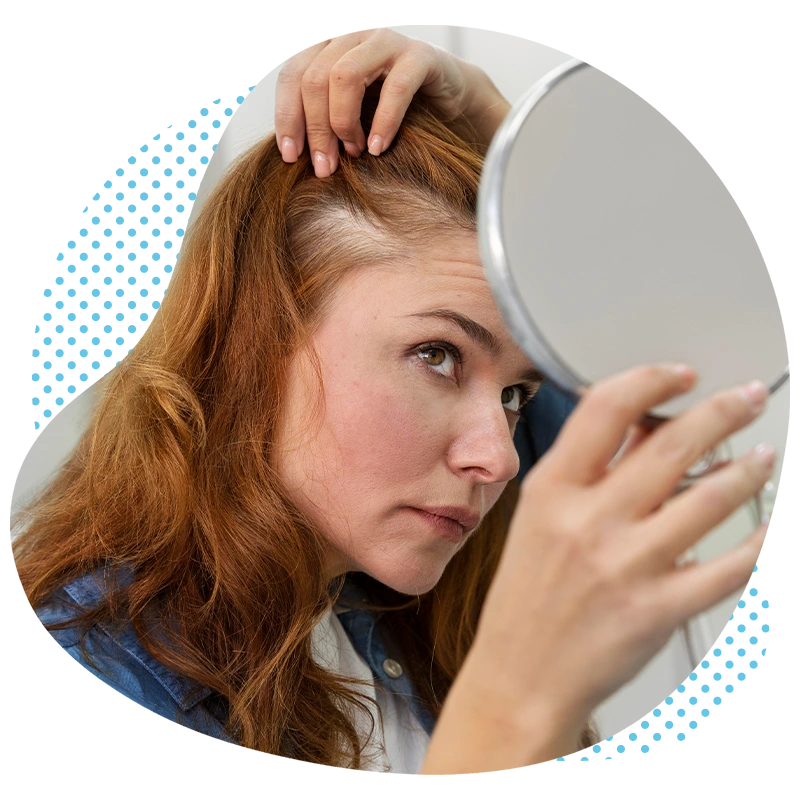 haartransplantation-frauen-turkei