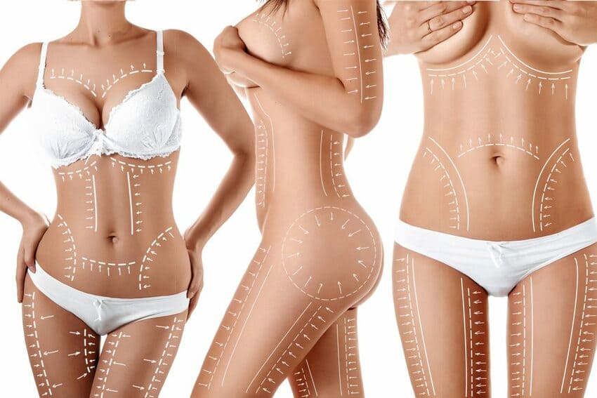 mommy makeover turkei antalya istanbul kosten