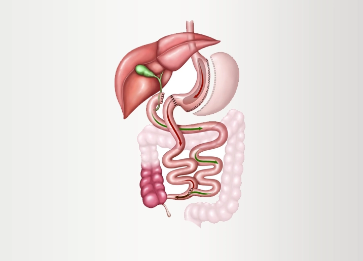transit-bipartition-turkei