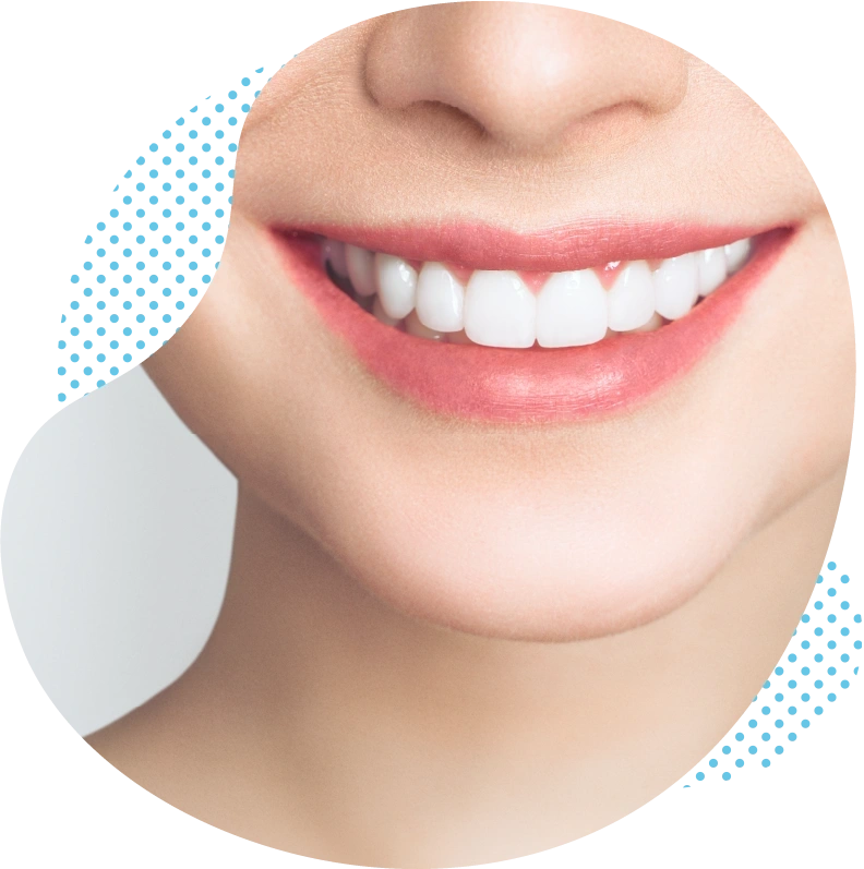Zahnbleaching türkei kosten